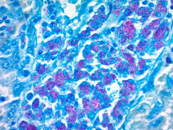 Acid Fast Staining – Principle, Procedure & Applications