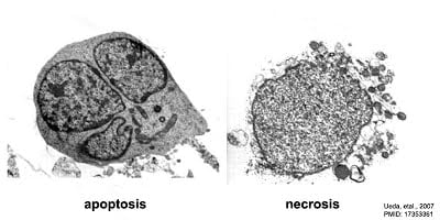 Difference between Apoptosis and Necrosis