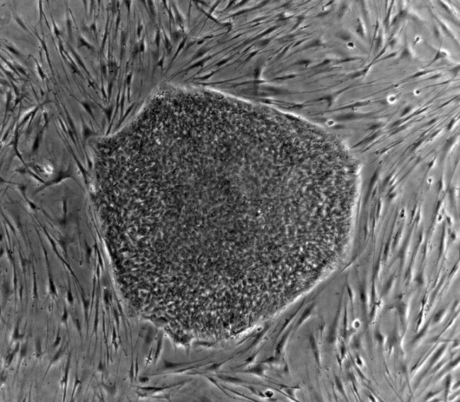 What is Stem Cell? Its types & Applications
