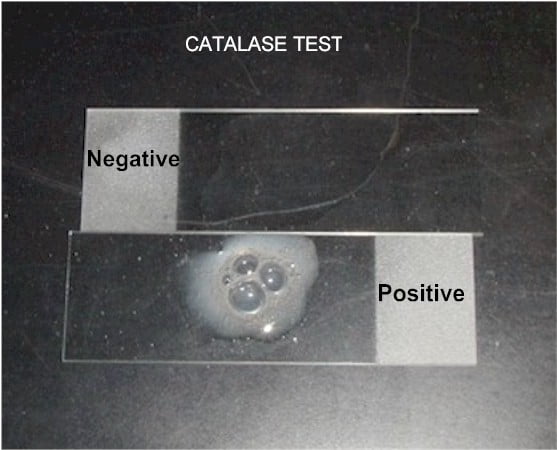 Catalase Test- Principle, Procedure and Result