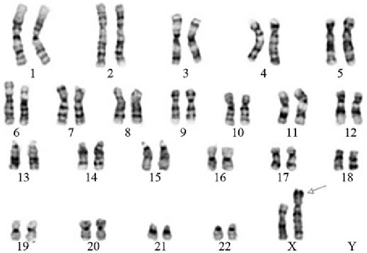 Different Techniques of Chromosome Banding