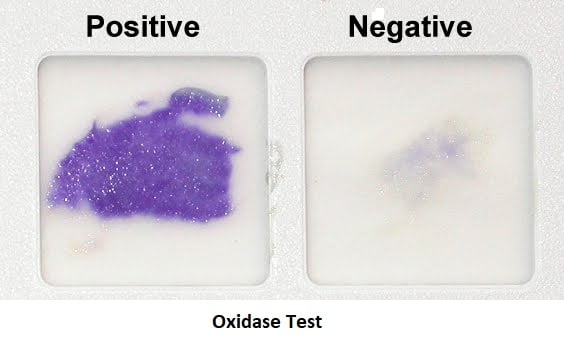 Oxidase Test – Principle, Procedure and Result