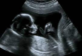 Reproductive System and Process in Humans