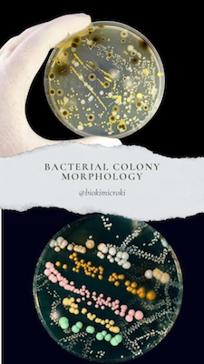 Bacterial Colony Morphology