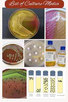 Classification and types of Culture Media used in Laboratory