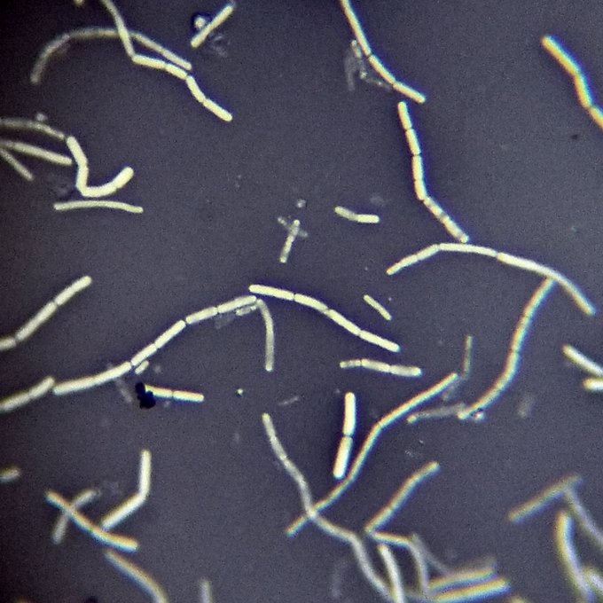Negative staining in basic staining technique
